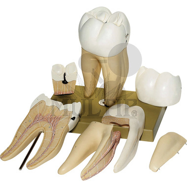 Pravá dolní první stolička