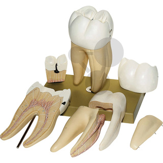 Pravá dolní první stolička