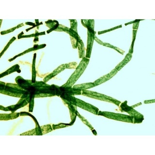 Preparáty-Podivuhodná stavba rostlinných buněk