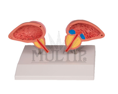 Prostata-model, 2 části